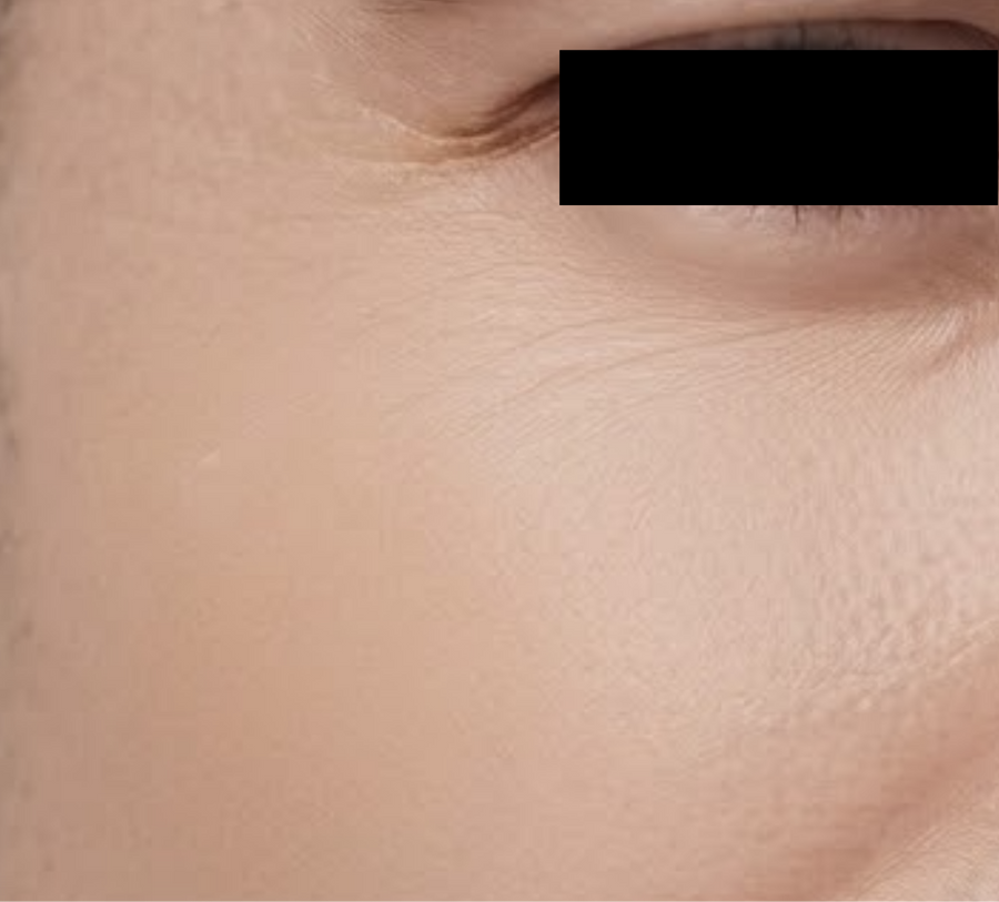 Skin after using ACEBLUR