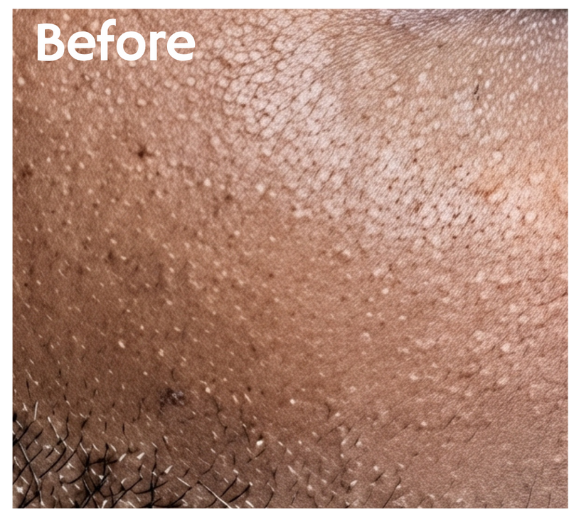 Skin before using ACEBLUR