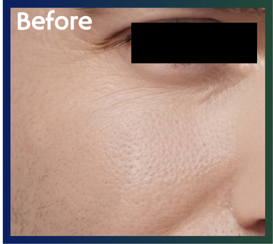 Skin before using ACEBLUR